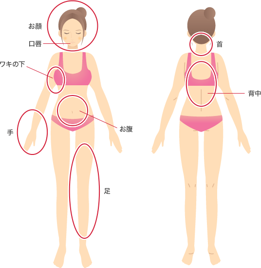 しみ・くすみ治療可能部位